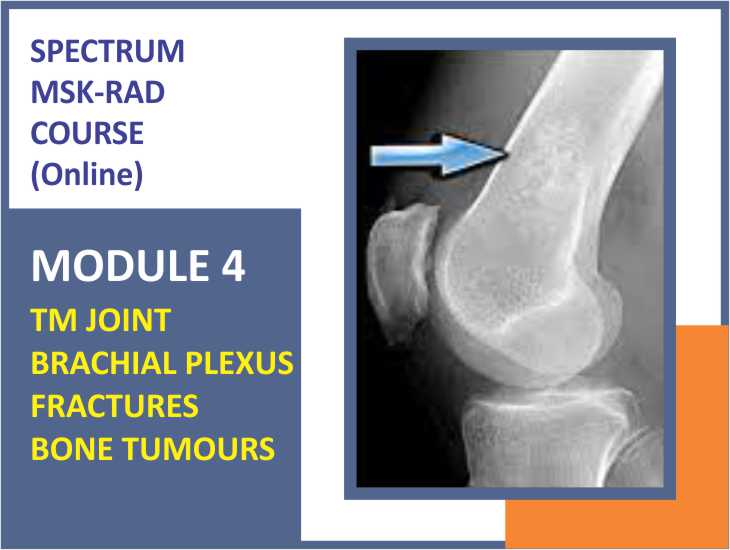 TM joint, Brachial plexus, Fractures and Bone Tumours​